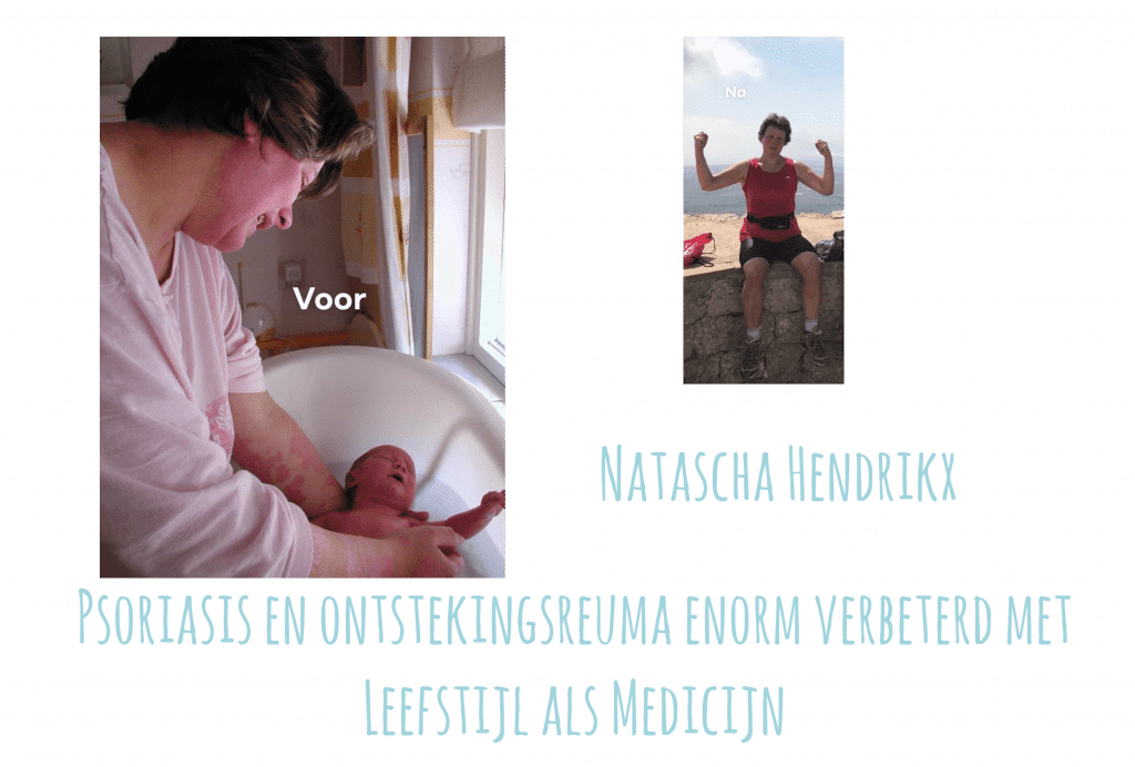 Natascha Hendrikx Psioriasis en Ontstekingsreuma